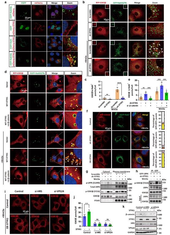 Nature子刊丨唐景峰/周策凡团队阐述囊泡调控Wnt/β-catenin通路及胰腺癌最新进展
